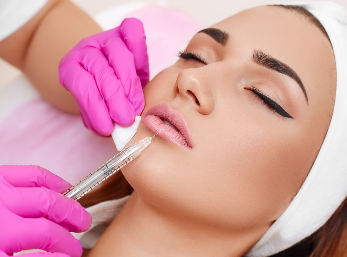 Lip filler