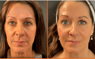 Natural Is the New “In”: The Rise of Regenerative Aesthetics