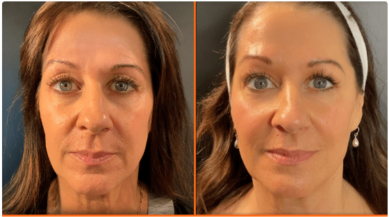 Natural Is the New “In”: The Rise of Regenerative Aesthetics