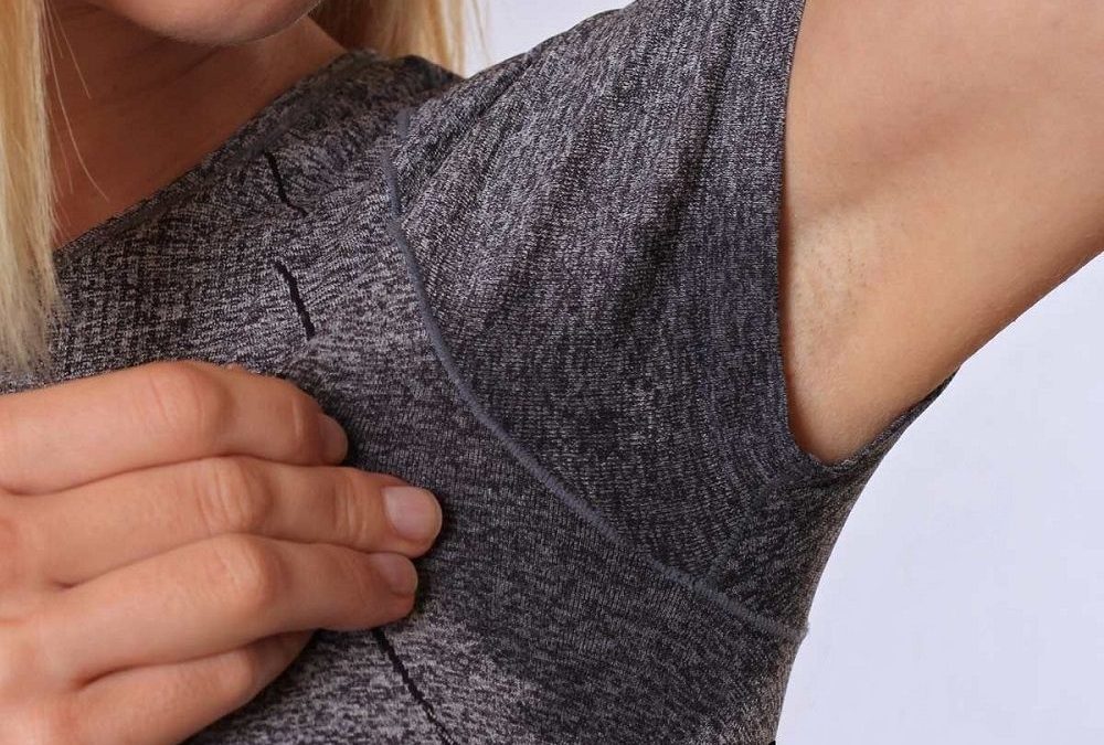 Morpheus8 Optimas Max: The Ultimate Hyperhidrosis Treatment