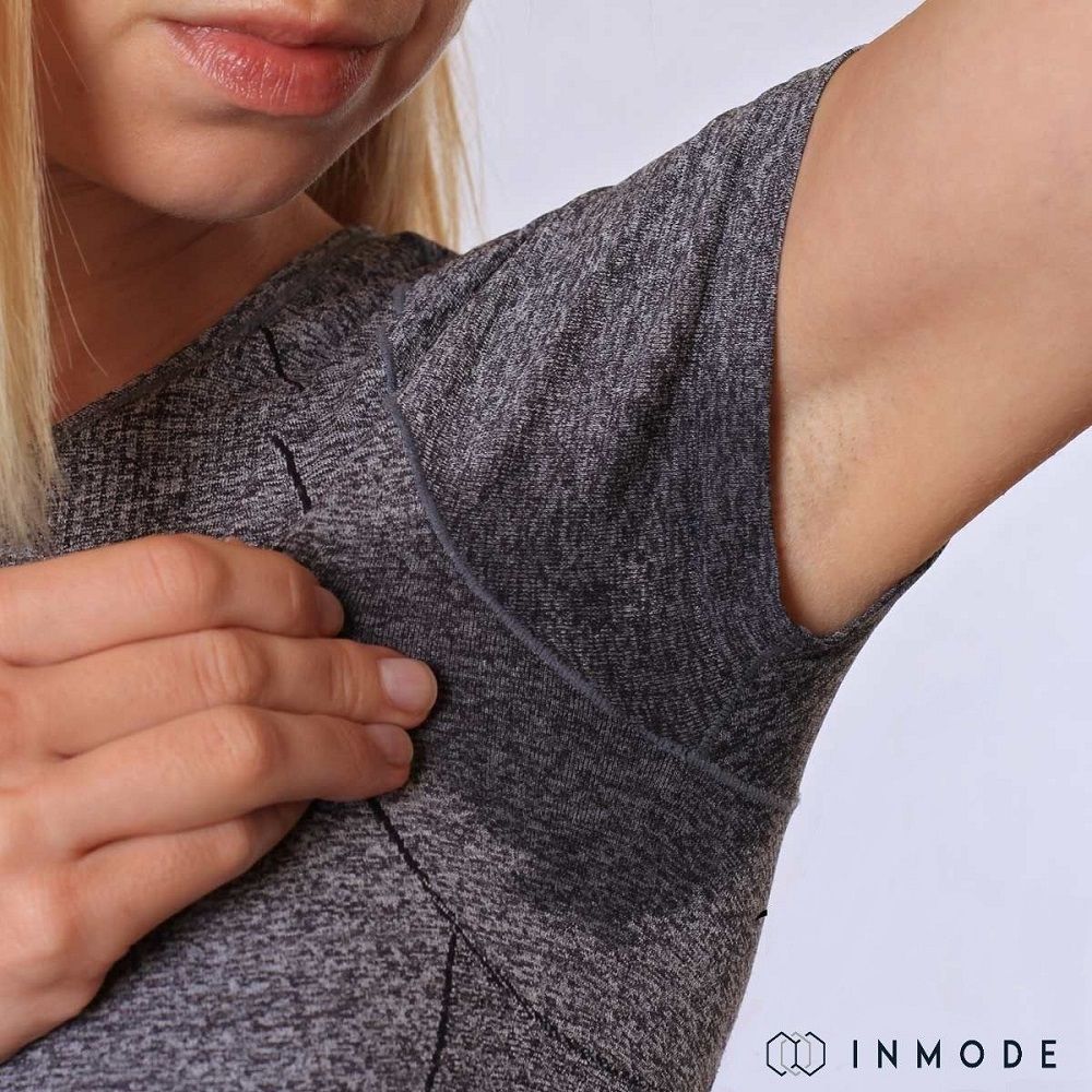 Hyperhidrosis Morpheus8 beautiTree