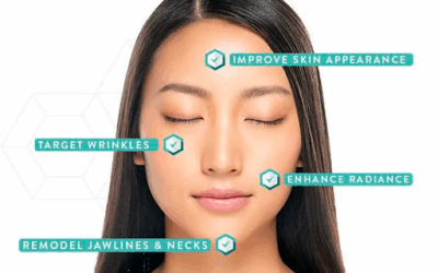 Forma RF Skin Tightening: The Gentle “Red Carpet” Treatment